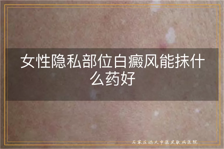 女性隐私部位白癜风能抹什么药好