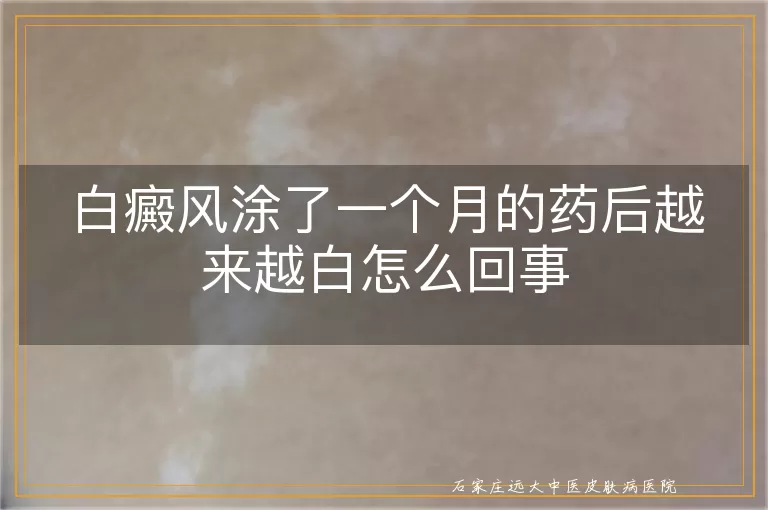 白癜风涂了一个月的药后越来越白怎么回事