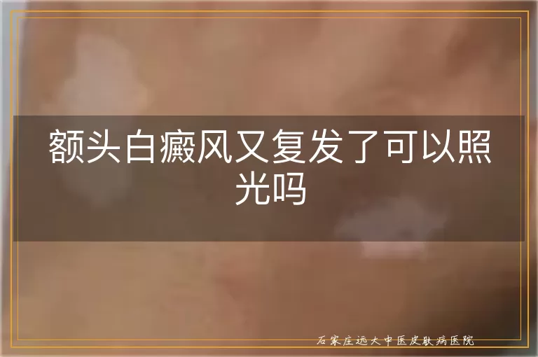 额头白癜风又复发了可以照光吗