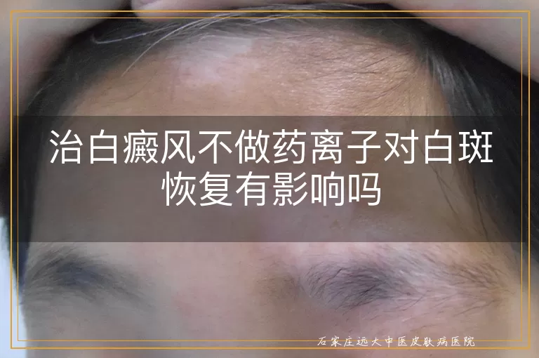 治白癜风不做药离子对白斑恢复有影响吗