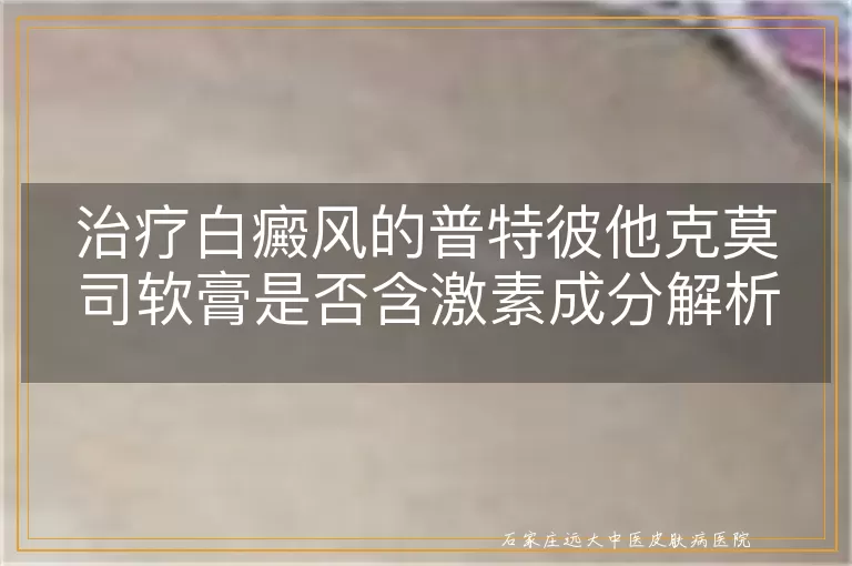 治疗白癜风的普特彼他克莫司软膏是否含激素成分解析