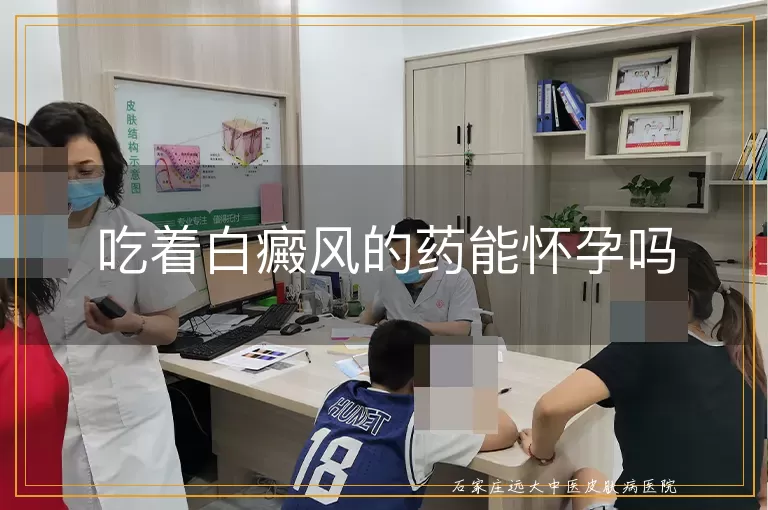 吃着白癜风的药能怀孕吗