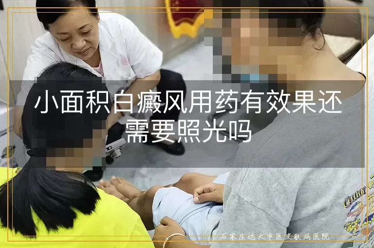 小面积白癜风用药有效果还需要照光吗