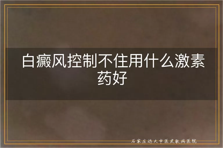 白癜风控制不住用什么激素药好