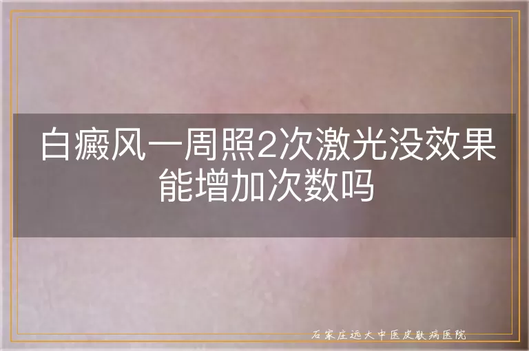 白癜风一周照2次激光没效果能增加次数吗