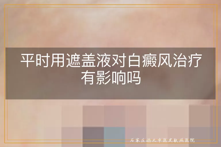 平时用遮盖液对白癜风治疗有影响吗