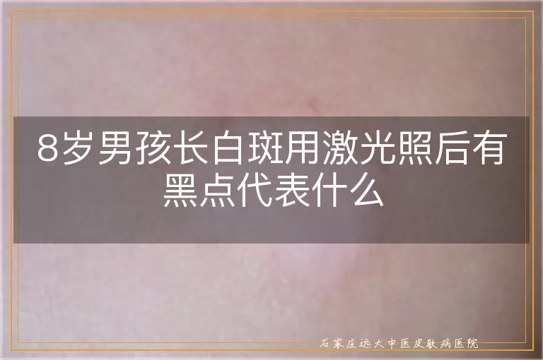 8岁男孩长白斑用激光照后有黑点代表什么