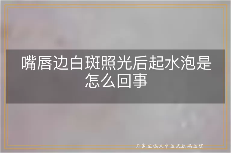 嘴唇边白斑照光后起水泡是怎么回事