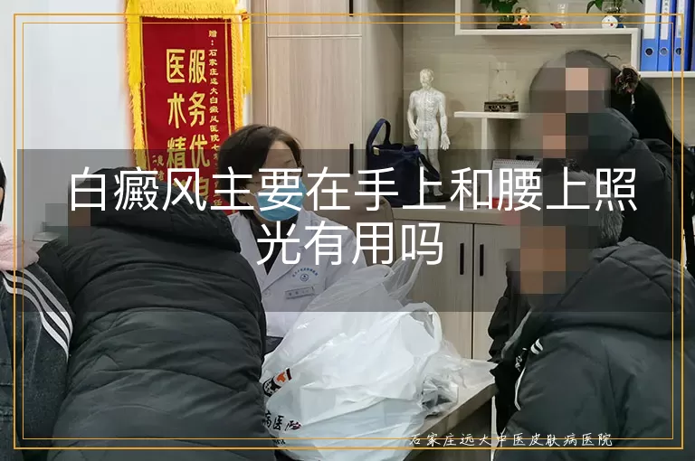 白癜风主要在手上和腰上照光有用吗