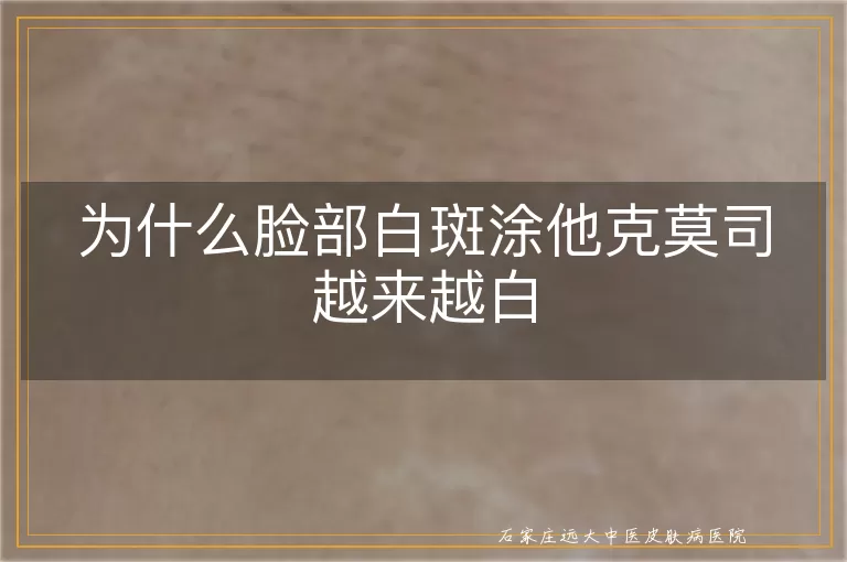 为什么脸部白斑涂他克莫司越来越白