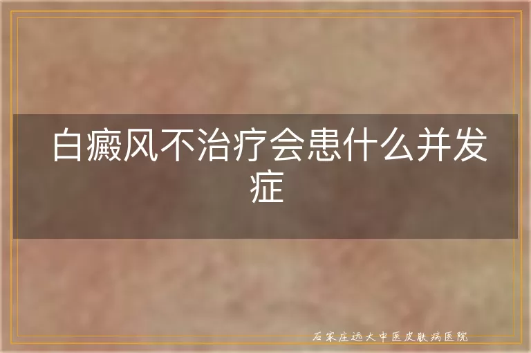 白癜风不治疗会患什么并发症