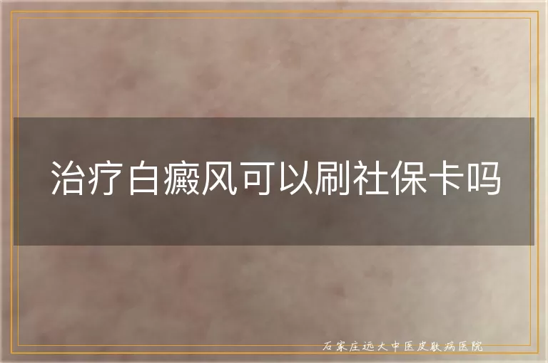 治疗白癜风可以刷社保卡吗