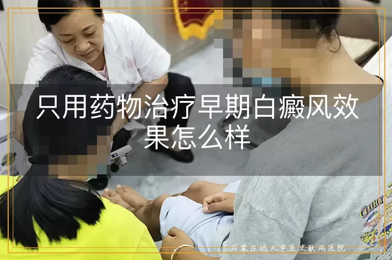 只用药物治疗早期白癜风效果怎么样