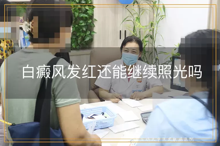 白癜风发红还能继续照光吗
