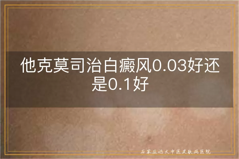 他克莫司治白癜风0.03好还是0.1好