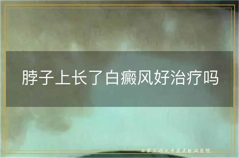 脖子上长了白癜风好治疗吗