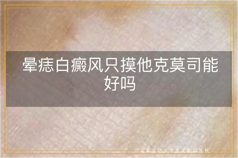 晕痣白癜风只摸他克莫司能好吗