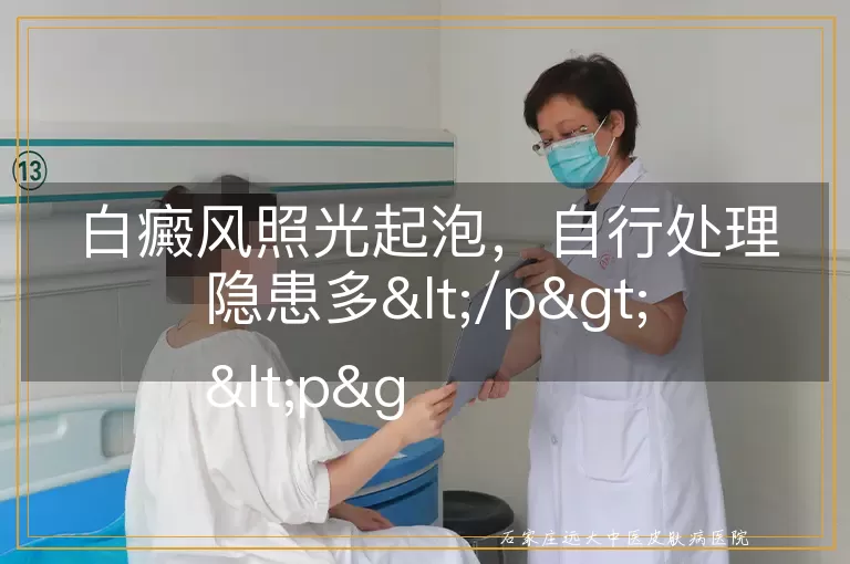 白癜风照光起泡，自行处理隐患多</p>
<p>