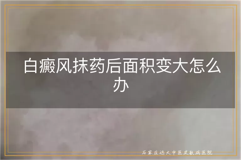 白癜风抹药后面积变大怎么办