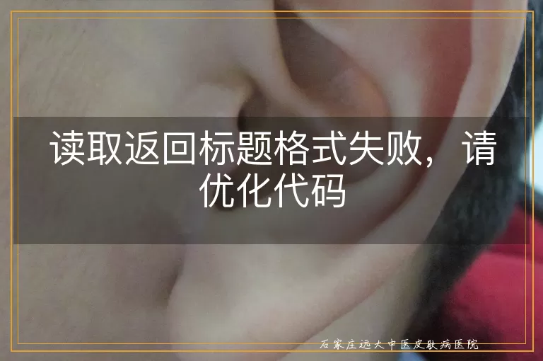 读取返回标题格式失败,请优化代码