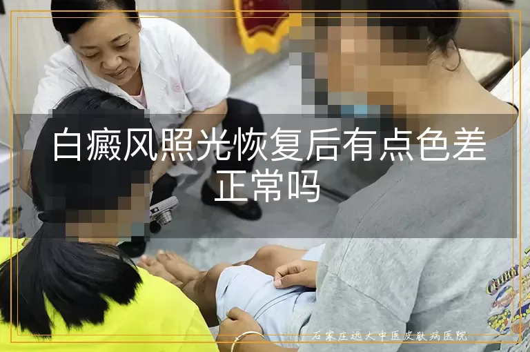 白癜风照光恢复后有点色差正常吗