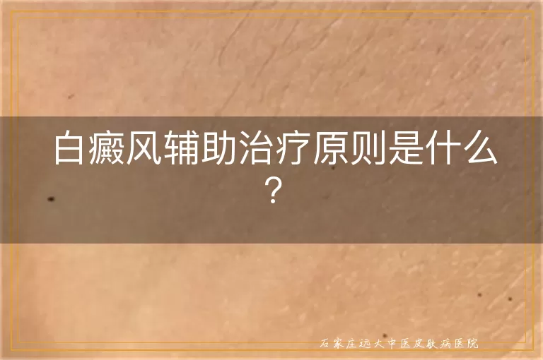 白癜风辅助治疗原则是什么?