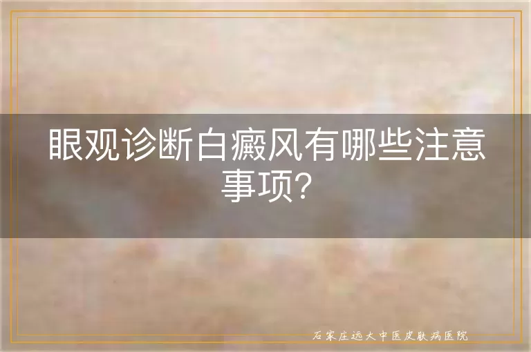 眼观诊断白癜风有哪些注意事项?