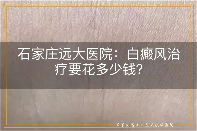 石家庄远大医院：白癜风治疗要花多少钱？