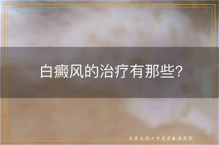 白癜风的治疗有那些?