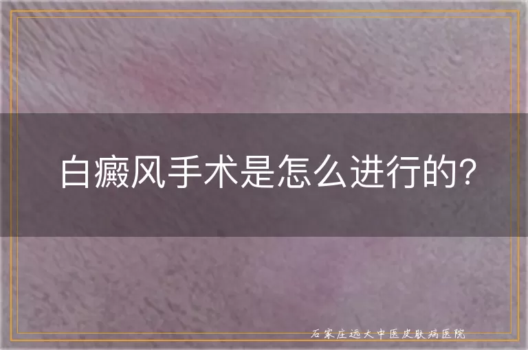 白癜风手术是怎么进行的?