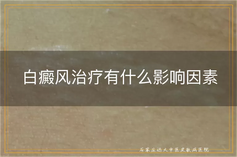 白癜风治疗有什么影响因素