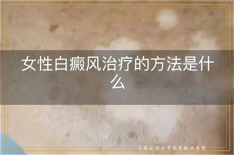 女性白癜风治疗的方法是什么