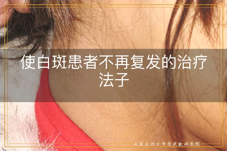 使白斑患者不再复发的治疗法子