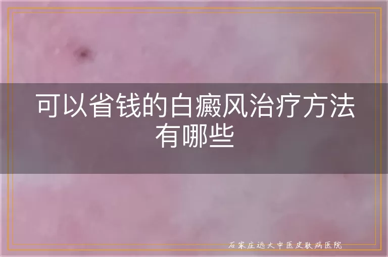 可以省钱的白癜风治疗方法有哪些