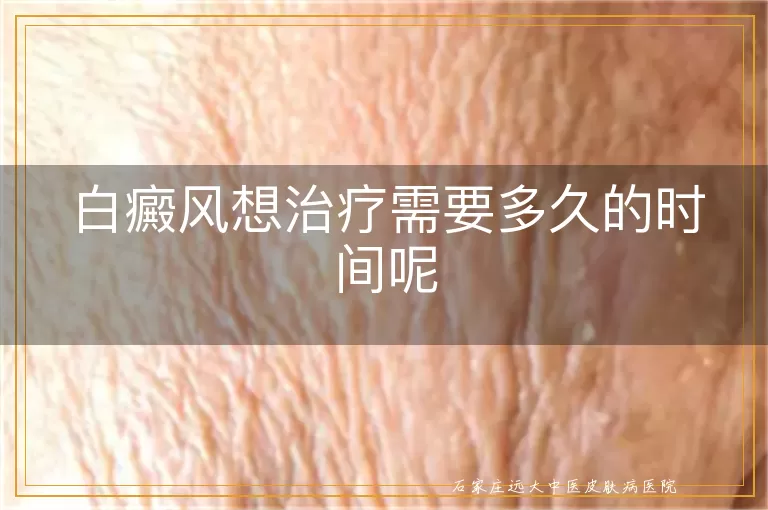 白癜风想治疗需要多久的时间呢