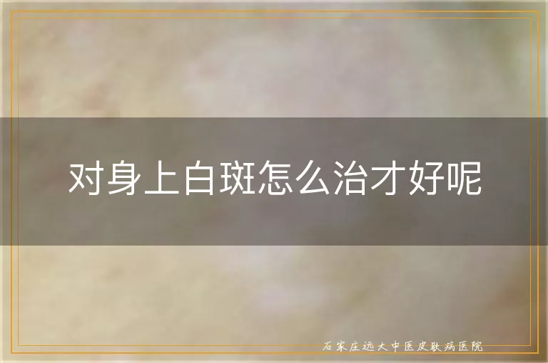 对身上白斑怎么治才好呢