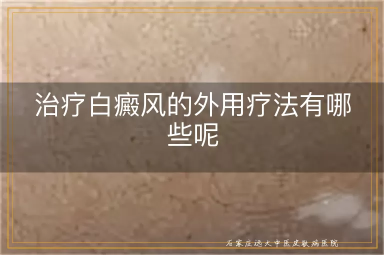 治疗白癜风的外用疗法有哪些呢