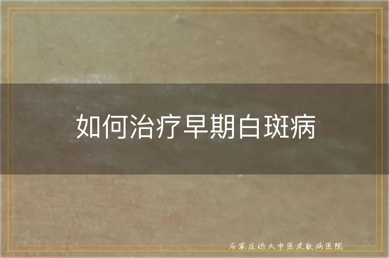 如何治疗早期白斑病