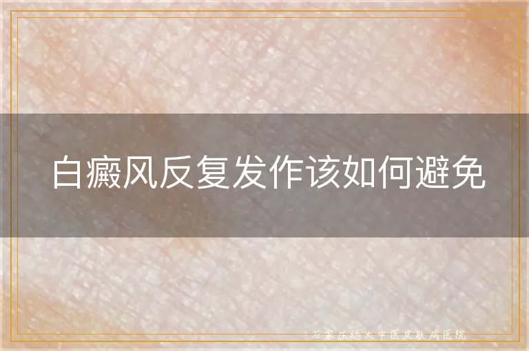 白癜风反复发作该如何避免