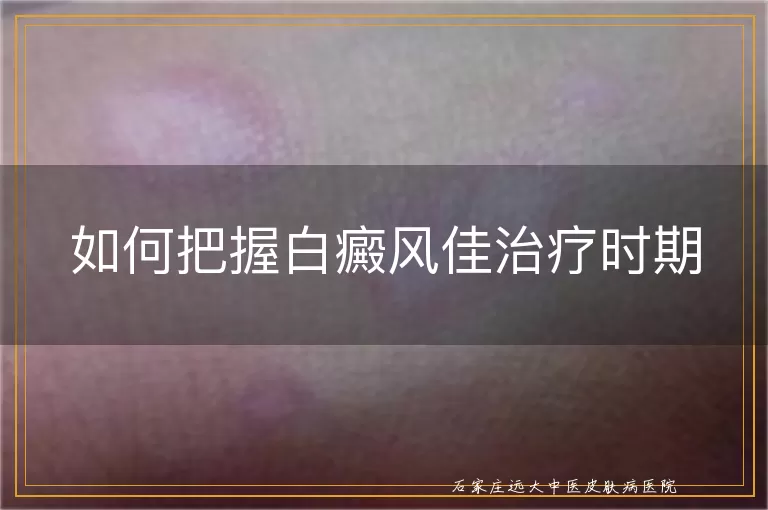 如何把握白癜风佳治疗时期