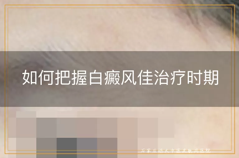 如何把握白癜风佳治疗时期