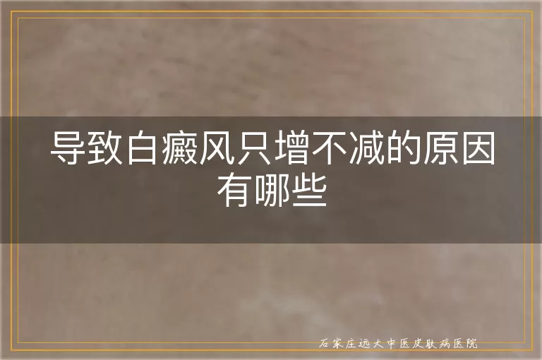 导致白癜风只增不减的原因有哪些