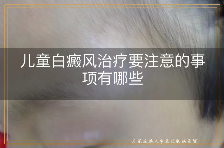 儿童白癜风治疗要注意的事项有哪些