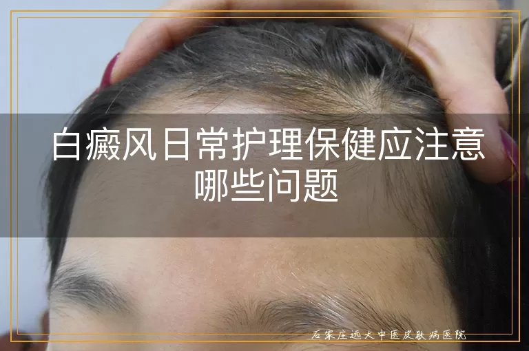 白癜风日常护理保健应注意哪些问题