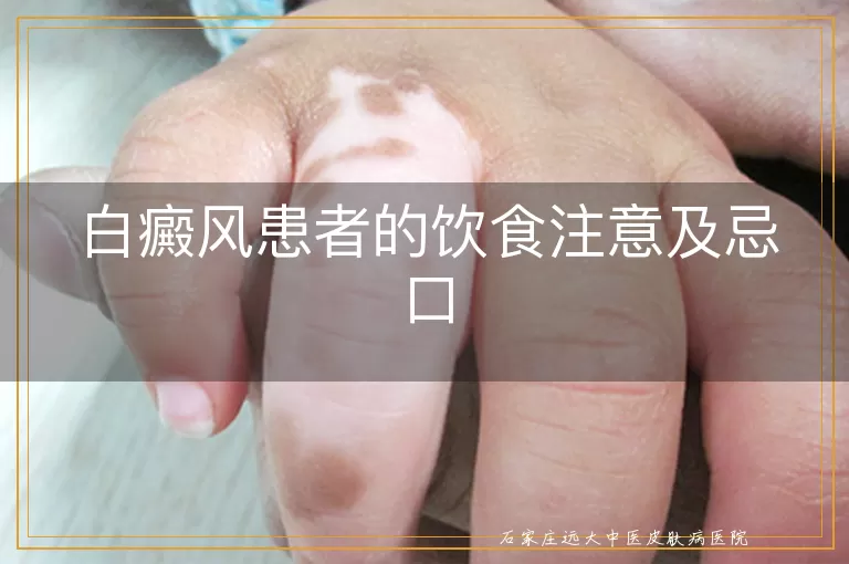 白癜风患者的饮食注意及忌口