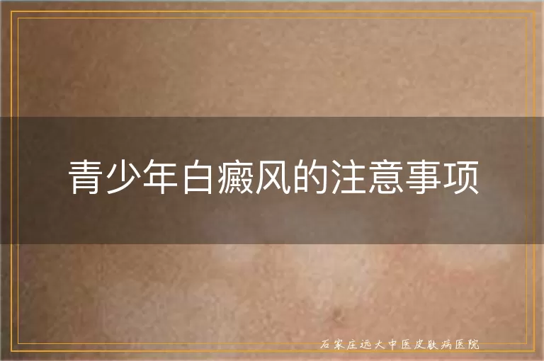 青少年白癜风的注意事项