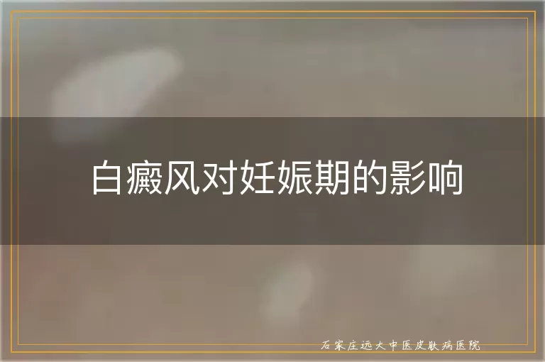 白癜风对妊娠期的影响