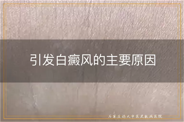 引发白癜风的主要原因