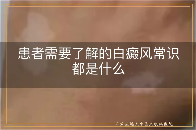 患者需要了解的白癜风常识都是什么