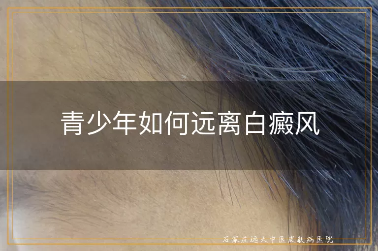 青少年如何远离白癜风